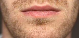 chin